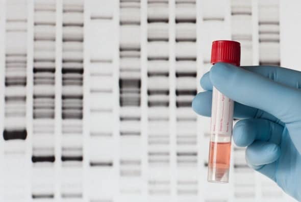 What To Do About A False Positive Drug Test
