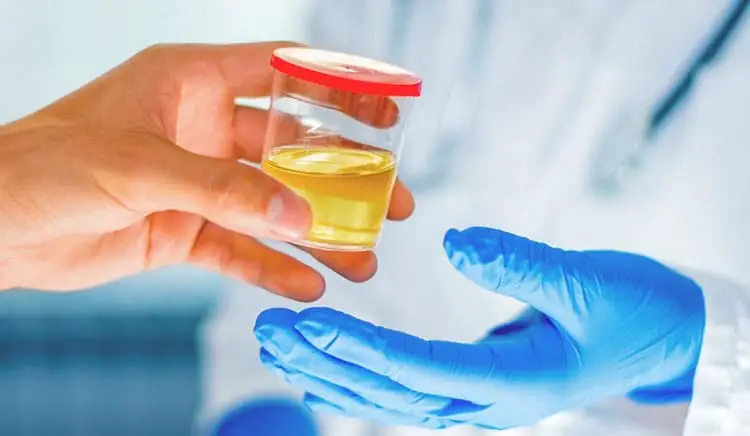 What Does DOT Physical Urine Test For
