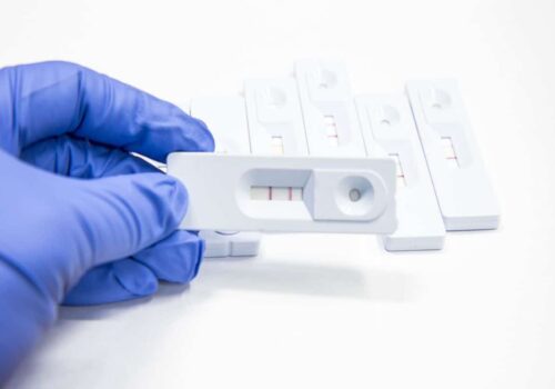 Can Drug Test Detect Pregnancy? Is It Accurate?