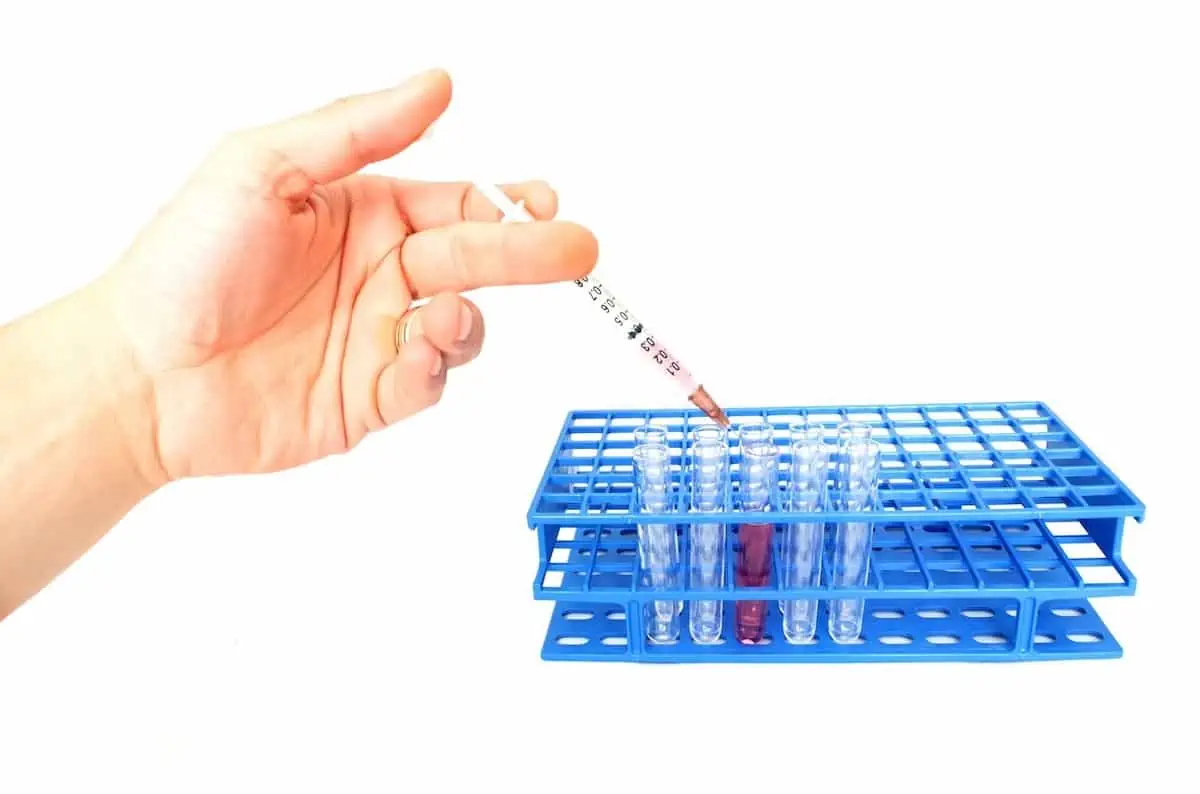 A hand putting the blood specimen in the test tube for drug testing. 